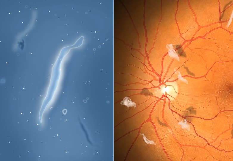 مگس پران و جرقه